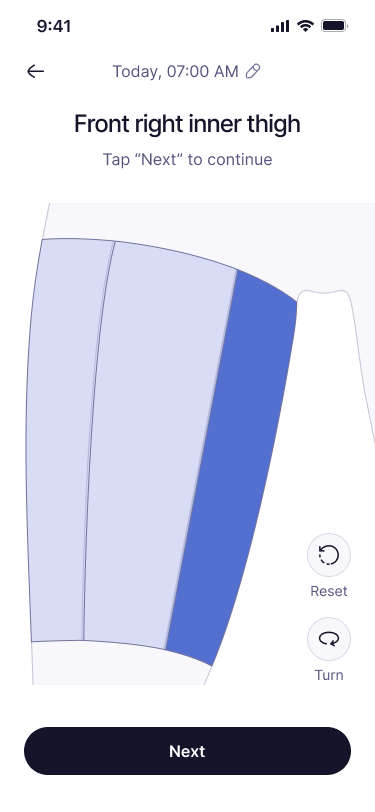 Add log — the body view zoomed in, with a region in its pressed state